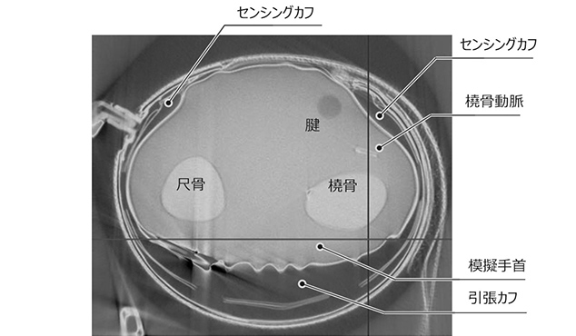 図13 引張方式のセンシングカフの様子